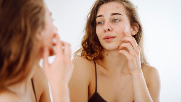 Kadın aynaya bakarak yüzündeki sivilce izlerini kontrol ediyor.