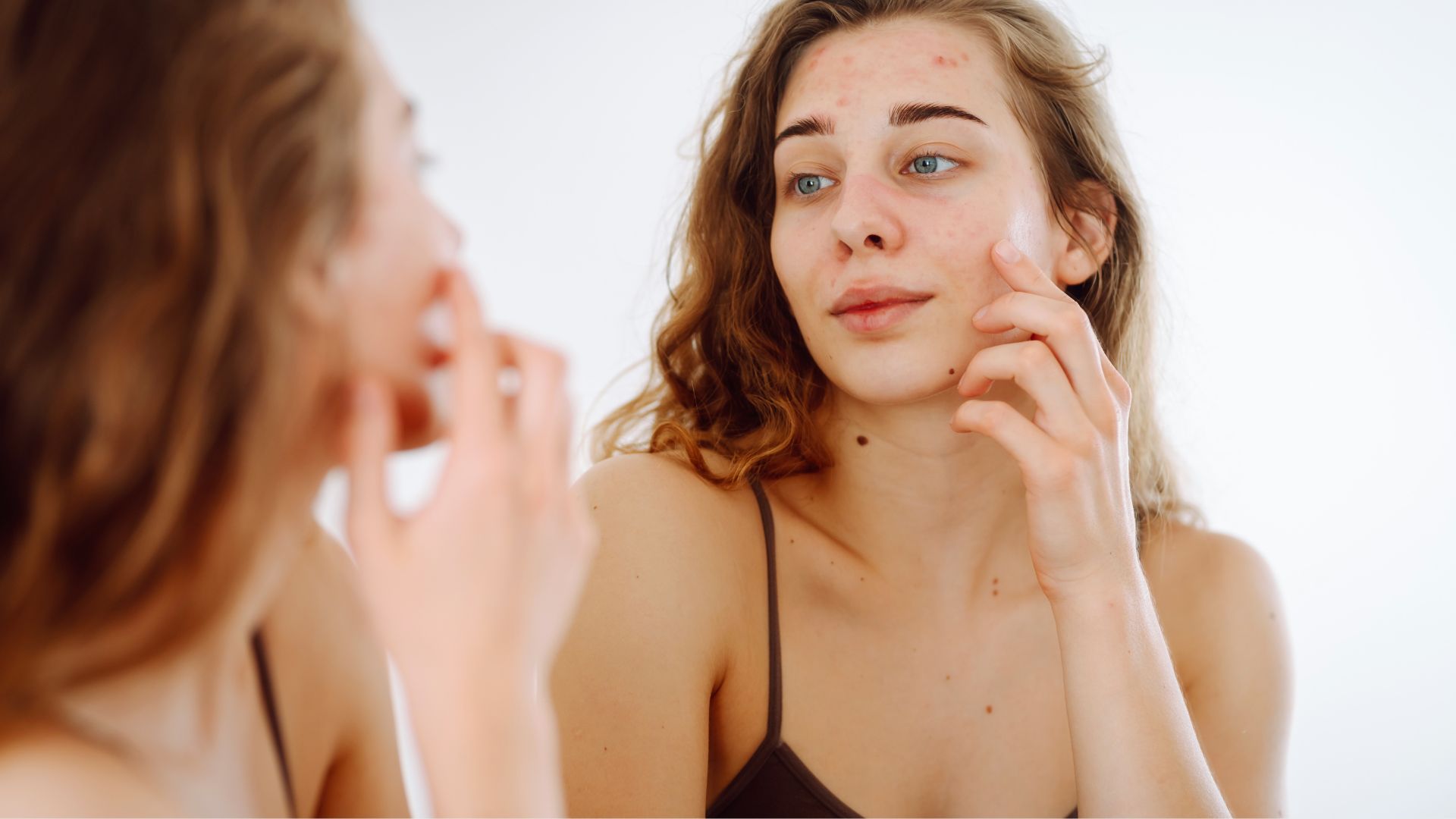 Kadın aynaya bakarak yüzündeki sivilce izlerini kontrol ediyor.